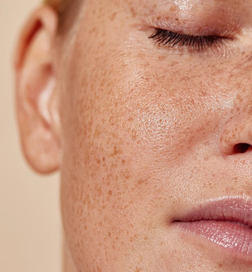 Five Tips for Healthy Skin