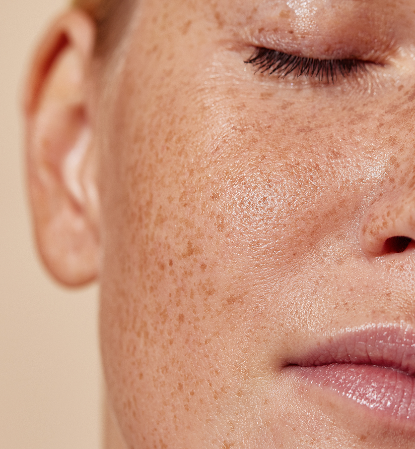 Five Tips for Healthy Skin