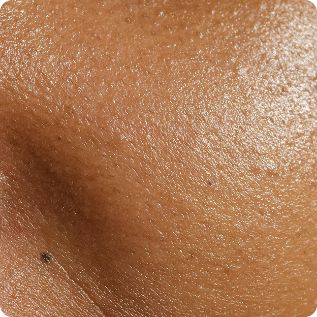 Genaura Improving hydration