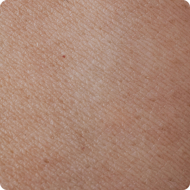 Calms and soothes dehydrated skin​