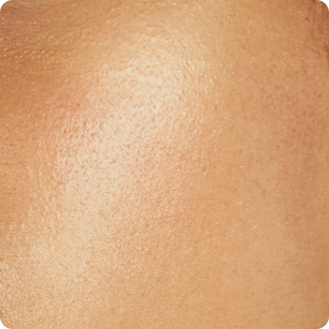 Supports skin turnover for healthy skin cell renewal​