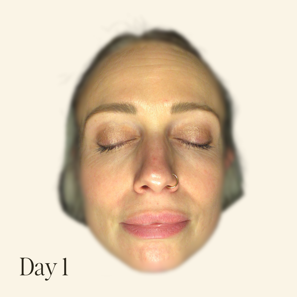 Genaura levagen+ Results Reduced appearance of fine lines Shrink 1