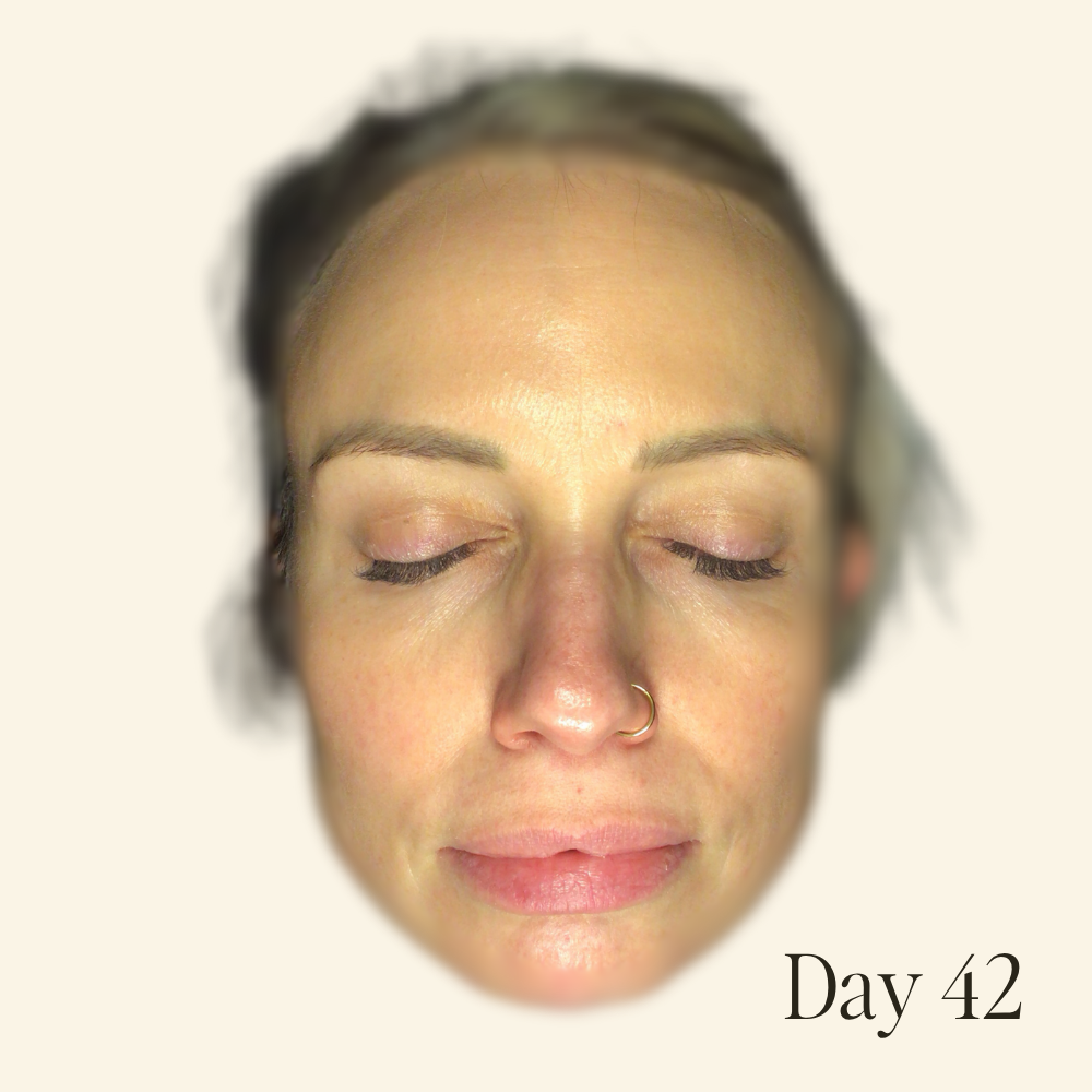 Genaura levagen+ Results Reduced appearance of fine lines Shrink 2