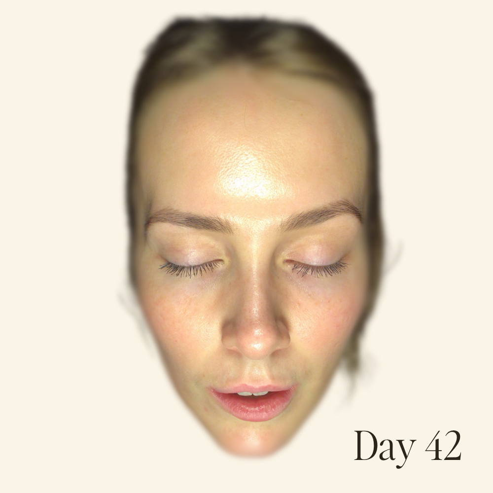 Genaura levagen+ Results Reduces dryness & dullness Shrink 2