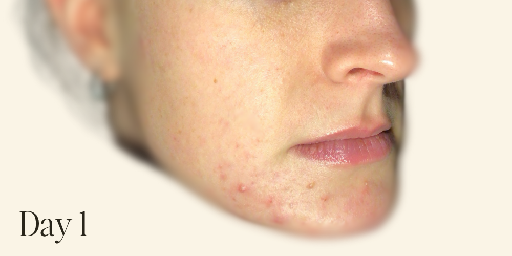 Genaura levagen+ Results zoom 1