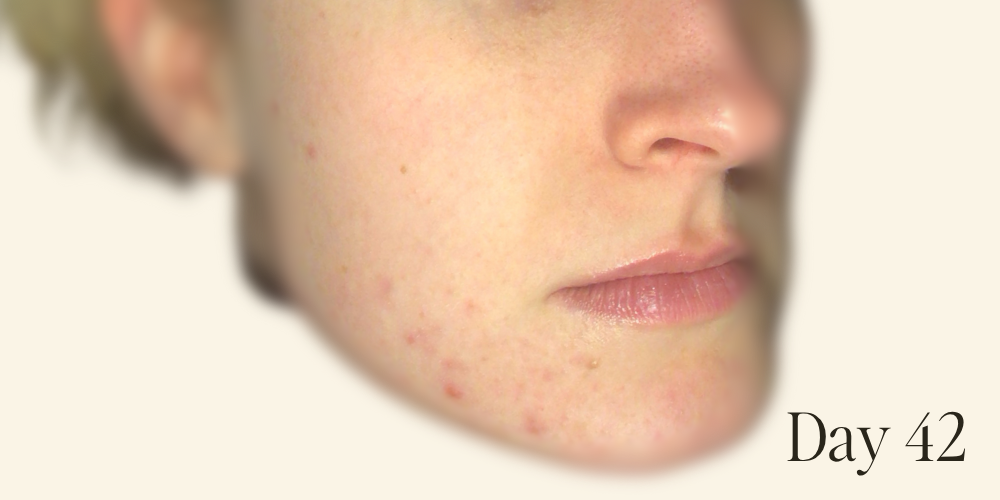 Genaura levagen+ Results zoom 2