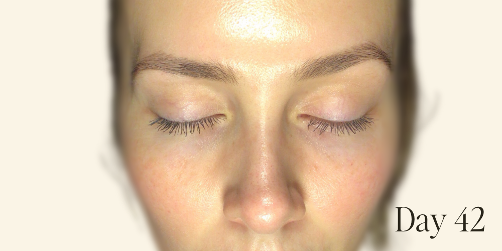 Genaura levagen+ Results zoom 4