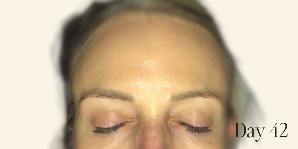 Genaura levagen+ Results zoom 6